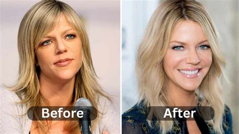 kaitlin olsen plastic surgery|Kaitlin Olson Plastic Surgery: ‘Sunny’ Star Responds to Speculation